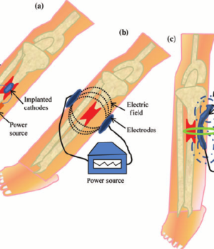 electric healing of fractures