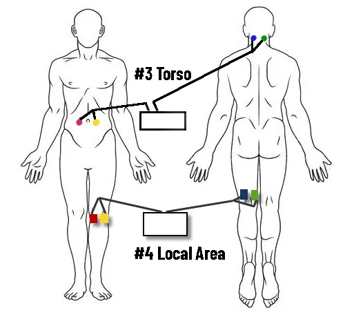 pad placement 1