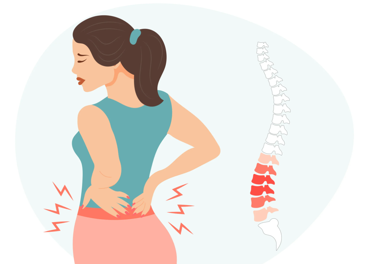 low back pain